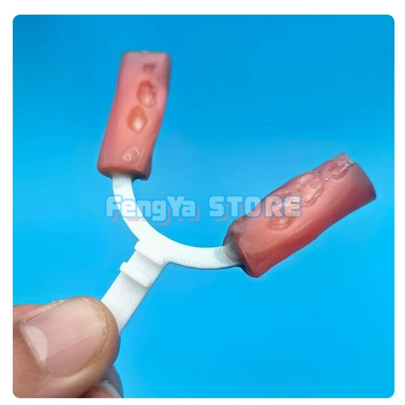 10개/봉투 교정용 하악 확장 바이트 포크 치과 연구소 - 3D Printing Orthodontics 리뷰 및 가격