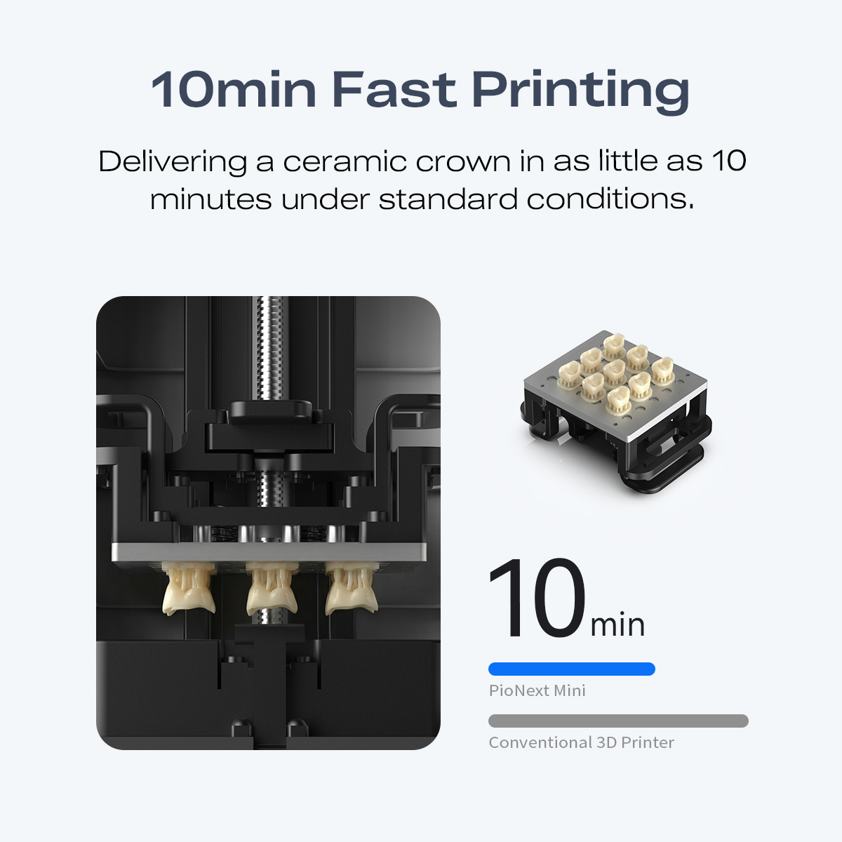 미니 고정밀 치과용 3D 프린터 9K 해상도, 치아 교 - 3D Printing Orthodontics 리뷰 및 가격