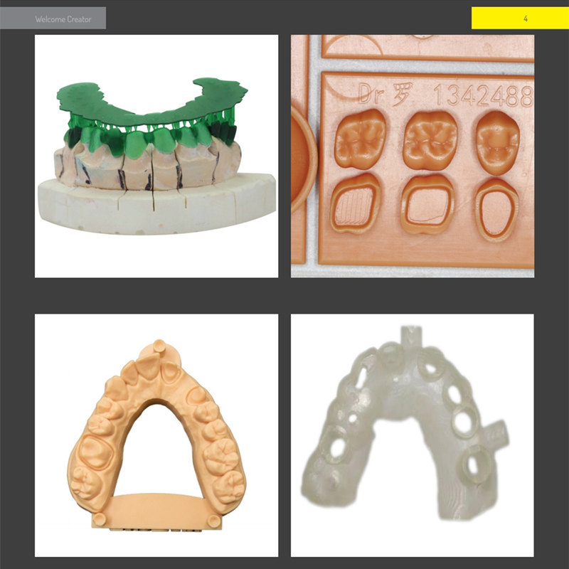 치과 3D 프린터 주조 금형, UV 임플란트 가이드 임 - 3D Printing Orthodontics 리뷰 및 가격