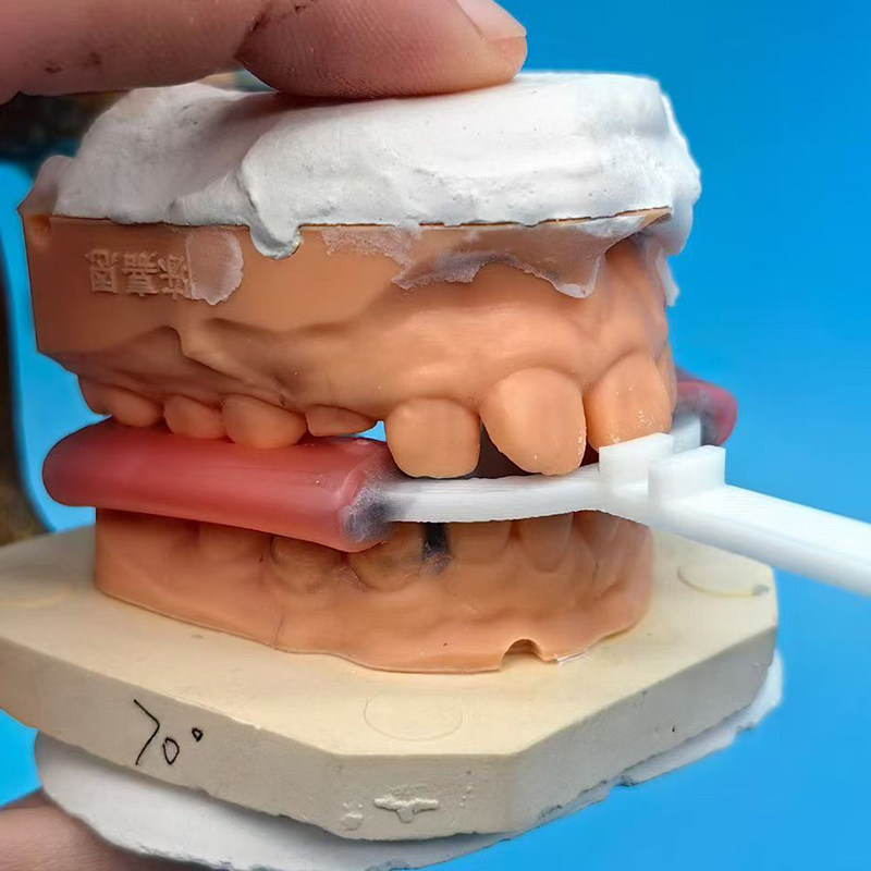 10개/봉투 치과용 바이트 포크 교정용 하악 확장기 치 - 3D Printing Orthodontics 리뷰 및 가격