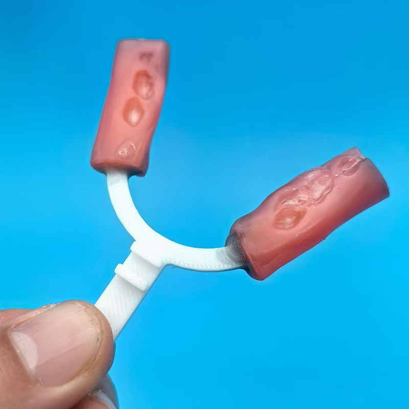 10개/봉투 치과용 바이트 포크 교정용 하악 확장기 치 - 3D Printing Orthodontics 리뷰 및 가격