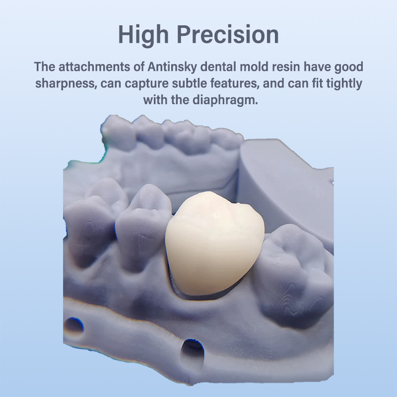 안틴스키 임시 치과 모형 레진 405nm 0.5kg ( - 3D Printing Orthodontics 리뷰 및 가격